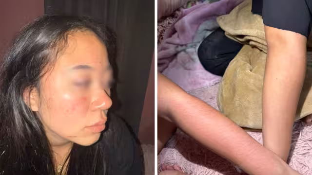 Directora de Deportes acusada de golpear a joven en evento público