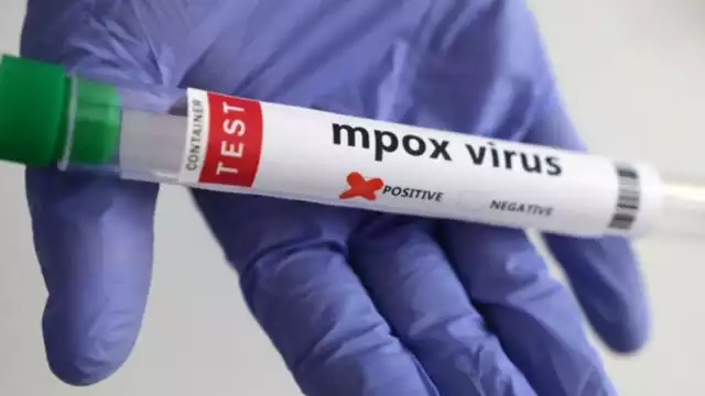 Campeche sin cerco sanitario, pero en guardia ante repunte de mpox vecino