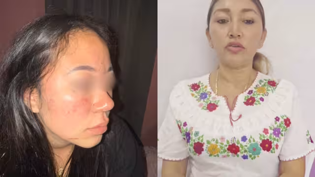 Destituyen a directora de Deportes en Candelaria por agresión a universitaria