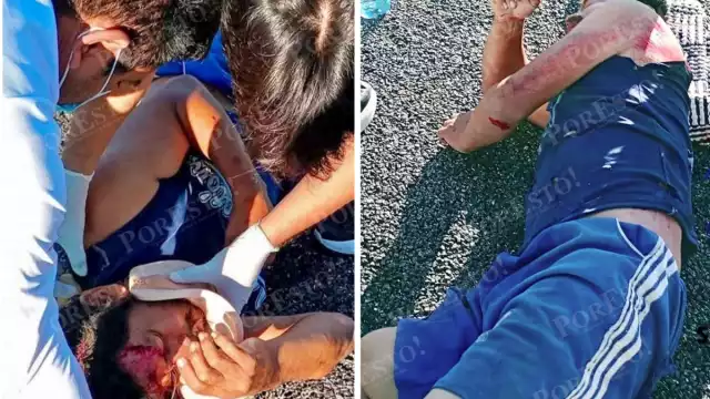 Sin testigos ni identidad: víctima de atropellamiento en Seybaplaya bajo investigación