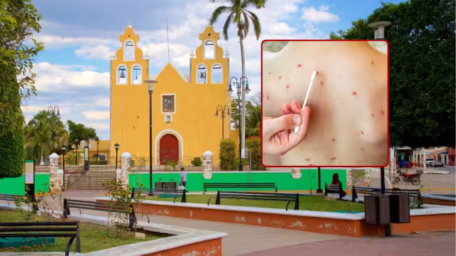 Refuerzan cerco epidemiológico tras la Feria de la Miel y el Maíz 2025.