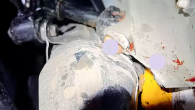 Menor de edad pierde dos dedos tras accidentes vehicular en Chetumal