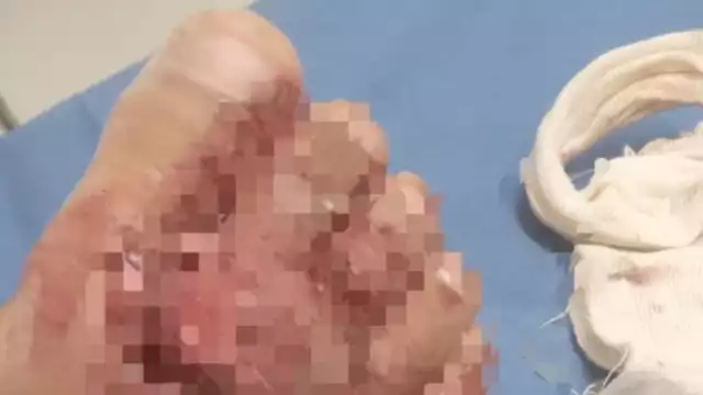 Menor de dos años es afectado por problemas familiares; mientras sus padres pelean por dinero, él se encuentra en espera de una cirugía