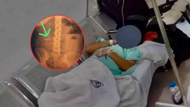 La afectada presentó fiebre, vómito y fuertes dolores días después de la operación en el Hospital General de Zona 18.