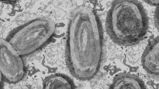 México reporta 212 casos probables y 49 confirmados de mpox en 2024