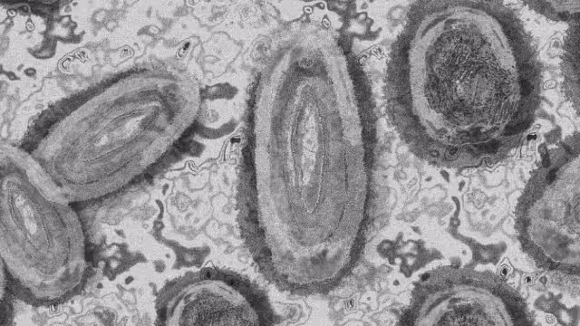 ¿Cómo identificar los síntomas del mpox en México?