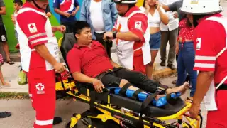 Motociclista termina fracturado de la pierna tras chocar en Ciudad del Carmen