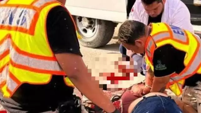 Paramédicos intentaron reanimar a la motociclista