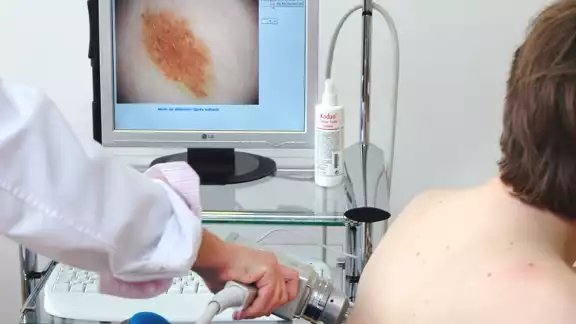 De acuerdo con organizaciones civiles, las cifras oficiales podrían ser mayores, debido a que muchas personas no acuden al doctor De acuerdo con organizaciones civiles, las cifras oficiales podrían ser mayores, debido a que muchas personas no acuden al doctor