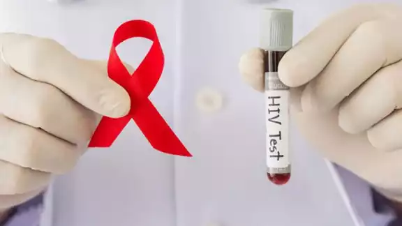 Una mujer es la tercera persona en curarse del VIH al utilizar un nuevo método de trasplante que involucra la sangre del cordón umbilical y abre la posibilidad de curar a más personas