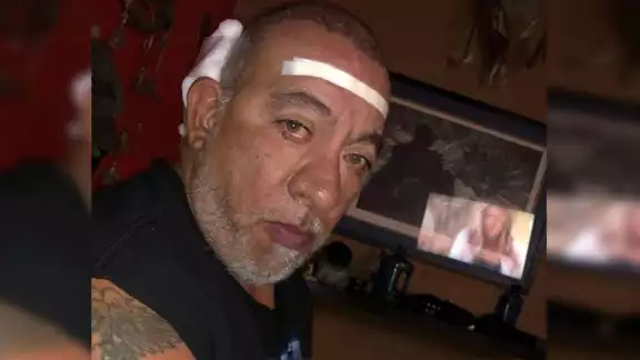 Carlos Trejo es hospitalizado: ¿Cuál es su estado actual de salud