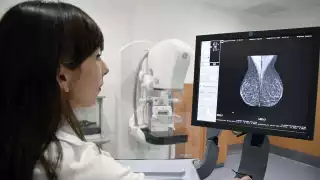 Estudios de mastografías gratuitos en Lázaro Cárdenas: Fechas, horarios y requisitos