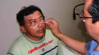 Síntomas y prevención: lo que debes saber sobre la conjuntivitis en temporada de calor