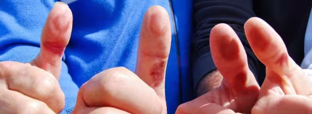 La razón por la que no debes subir fotos de tu dedo entintado después de votar