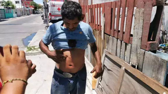 Hombre lesionado con arma blanca tras discusión con su pareja Hombre lesionado con arma blanca tras discusión con su pareja
