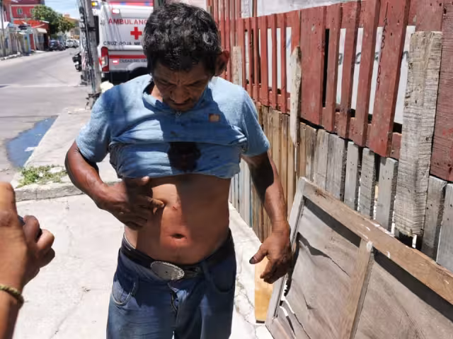 Hombre lesionado con arma blanca tras discusión con su pareja