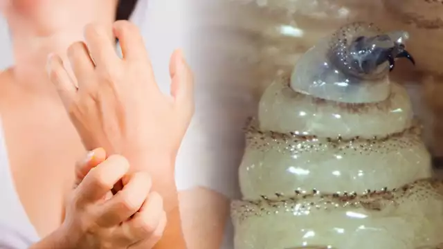 Las autoridades mantienen las medidas preventivas para que no pase de animales a personas