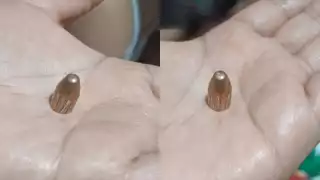 A punto de perder la vida un hombre por bala perdida