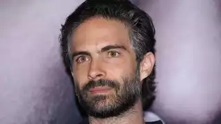 Osvaldo Benavides "Nandito", aparece con el rostro desfigurado; ¿Qué le sucedió?