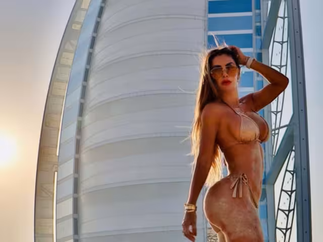 Este es el estado de salud de Ninel Conde tras fuerte accidente mientras esquiaba