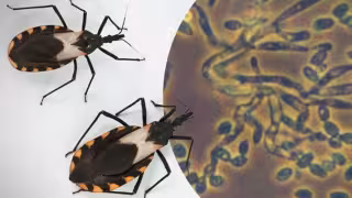 Mal de Chagas: cómo se transmite, cómo detectarlo y cómo prevenirlo