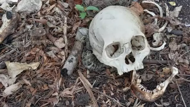 Osamenta descubierta por los dueños de un predio en Escárcega