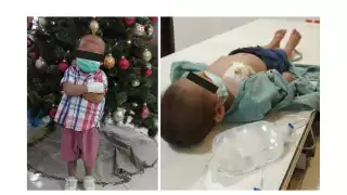 En Calakmul, claman ayuda para el pequeño Liam; padece leucemia