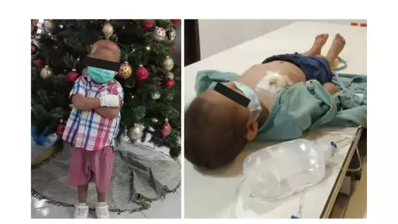 Familiares de Liam solicitan apoyo para recaudar fondos para su cirugía debido a que padece leucemia aguda.