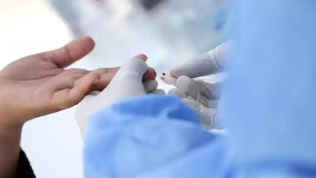 Los recientes contagios representan un reto para el sector Salud, pues se trata de un padecimiento que requiere detección oportuna y tratamiento constante.