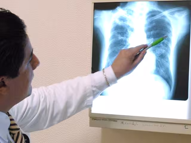 Pese a que se han registrado avances médicos, la bacteria sigue propagándose entre la población