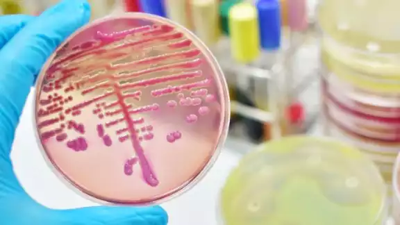 Esta bacteria es resistente a varios antibióticos