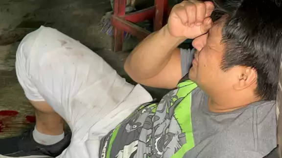 Hombre resiste ataque con balas en Campeche. Hombre resiste ataque con balas en Campeche.