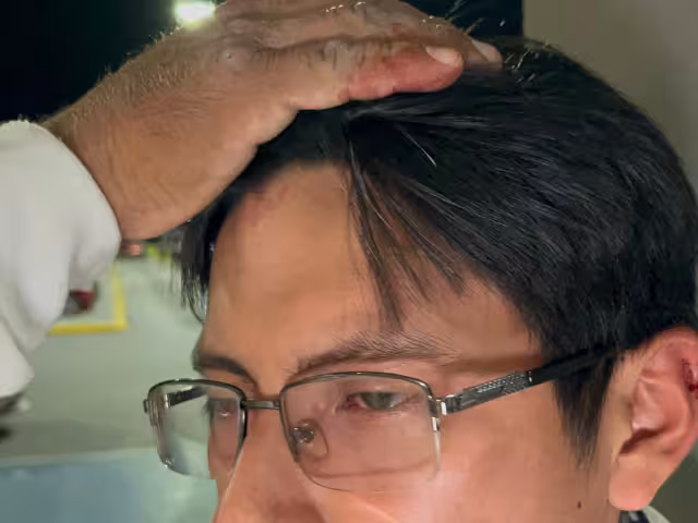 Joven fue golpeado en la cabeza en Campeche