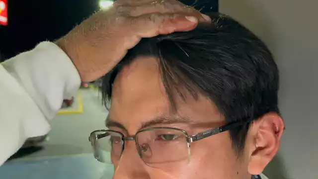 Joven fue golpeado en la cabeza en Campeche