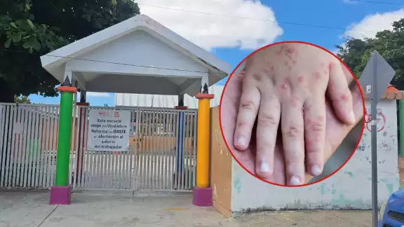 Representantes del municipio pidieron a los padres de familia que no lleven a sus hijos a los centros educativos si sospechan que están enfermos