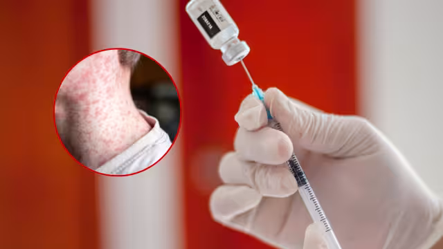 Niños menores de cinco años, adultos sin refuerzo y personas inmunodeprimidas son los grupos más vulnerables.