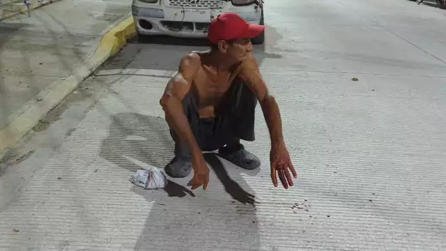 Según las dueñas del perro, el adulto mayor había intentado agredir al animal en varias ocasiones.