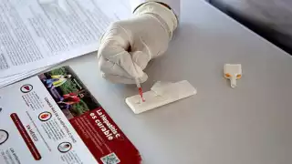 Casos de hepatitis C disminuyen 69.3% en Quintana Roo  