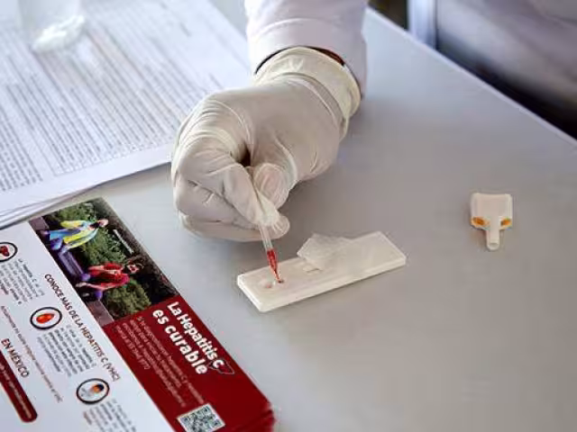 Solo una minoría de los infectados conoce su diagnóstico, lo que dificulta el control y la propagación del virus en la población