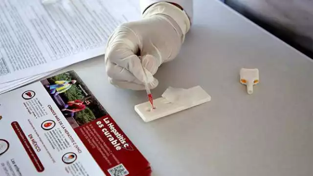 Solo una minoría de los infectados conoce su diagnóstico, lo que dificulta el control y la propagación del virus en la población