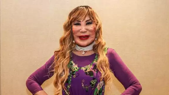 Lyn May asegura que se someterá a una nueva cirugía de rostro Lyn May asegura que se someterá a una nueva cirugía de rostro