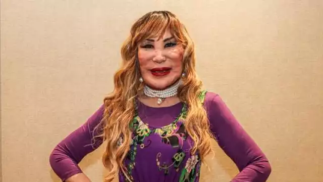 Lyn May asegura que se someterá a una nueva cirugía de rostro