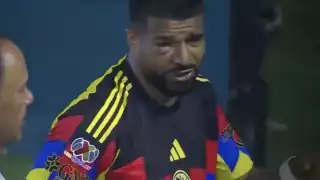 Así fue el brutal golpe que recibió Rodrigo Aguirre que le cerró el ojo