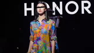 Padre de Valentina Gilabert revela    que está grave; podría perder la movilidad de una mano