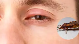 Se han capturado y analizado chinches mediante operativos en localidades