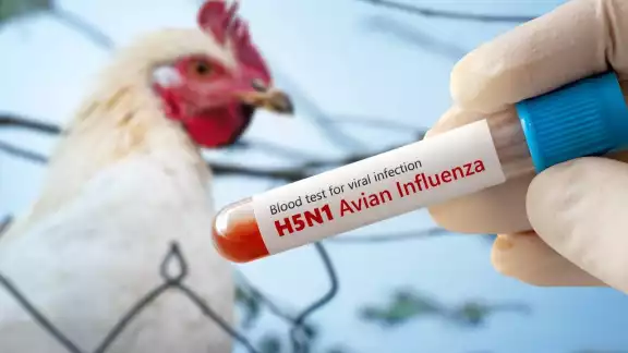 La gripe aviar (influenza aviar) es causada por variantes del virus tipo A, como H5N1