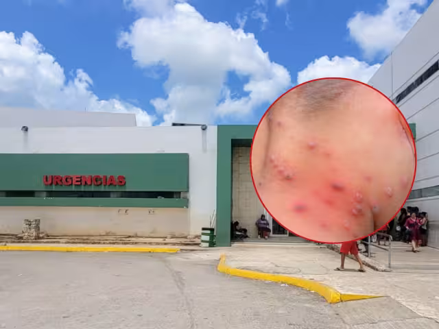 Quintana Roo ocupa el primer lugar en contagios por ronchas de la Península, mientras que Yucatán y Campeche ocupan el segundo y tercero, respectivamente