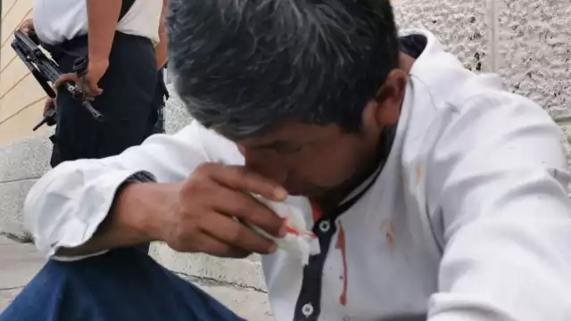 El hombre afectado fue valorado por paramédicos