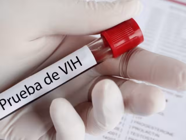 Tres nuevos casos de VIH en Campeche en últimos días de abril