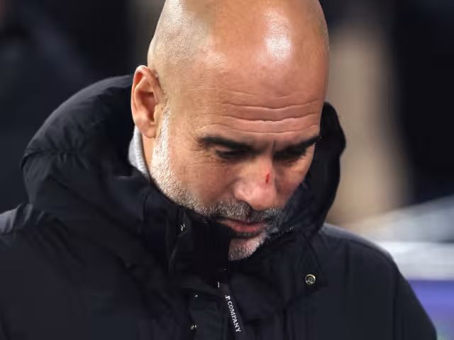 Pepe Guardiola y su rasguño en la nariz